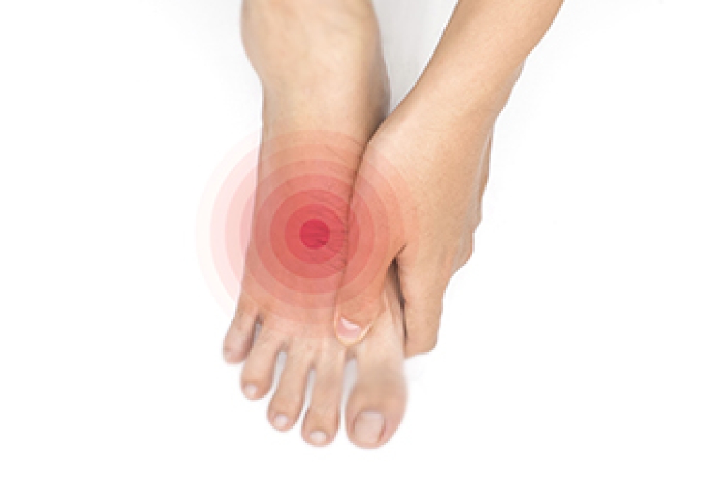 How Nerve Damage Contributes to Serious Foot Complications in Diabetic Patients