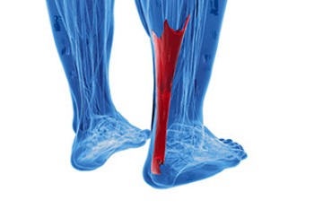 Causes and Symptoms of Achilles Tendonitis